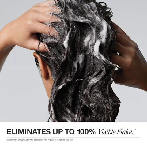 Dandruff Shampoo