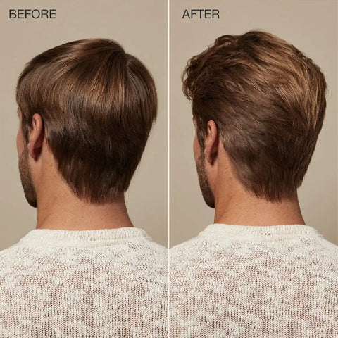 Scalp Care Regeniplex Tonic